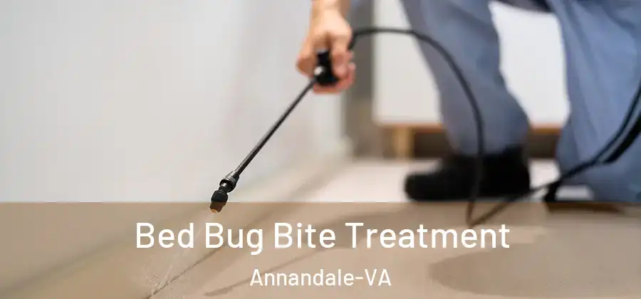  Bed Bug Bite Treatment Annandale-VA